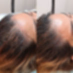 Hairline microblading