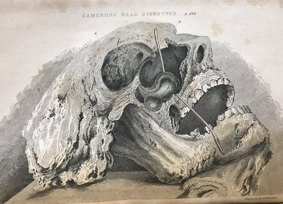 Thumbnail: Bell Principles of Surgery 1826