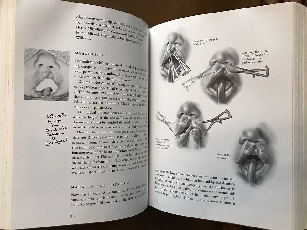 Thumbnail: Millard, Cleft Craft, The Evolution of Its Surgery, Millard, Inscribed, 1976