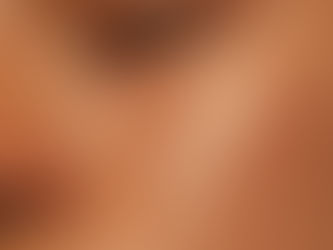 This is what happens if you don’t protect your skin from the sun...