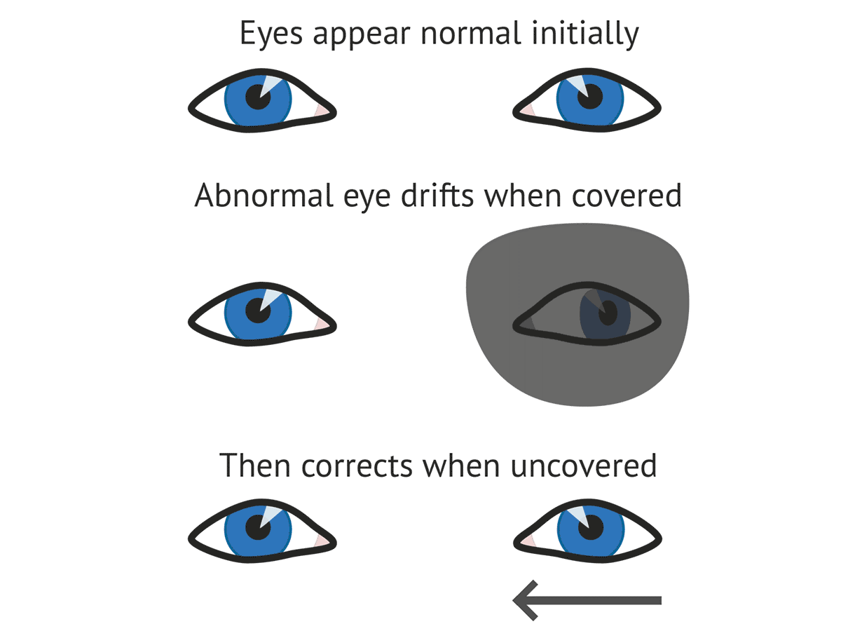 what is phoria