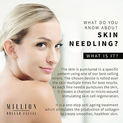 needling.jpeg