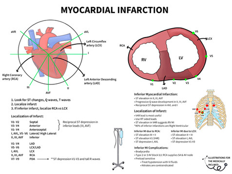 Cardiovascular | themedicallyinclined