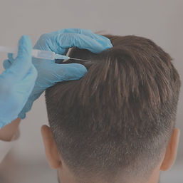 Perawatan rambut rontok dan kebotakan di SAÉ Clinique Gading Serpong