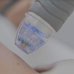 Perawatan Melasma di SAÉ Clinique Gading Serpong