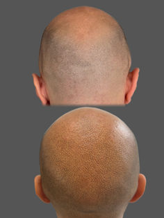 SMP Akademie Scalpcouple