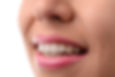 Invisalign1.jpg