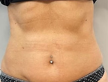 centre02-02 lysiwave