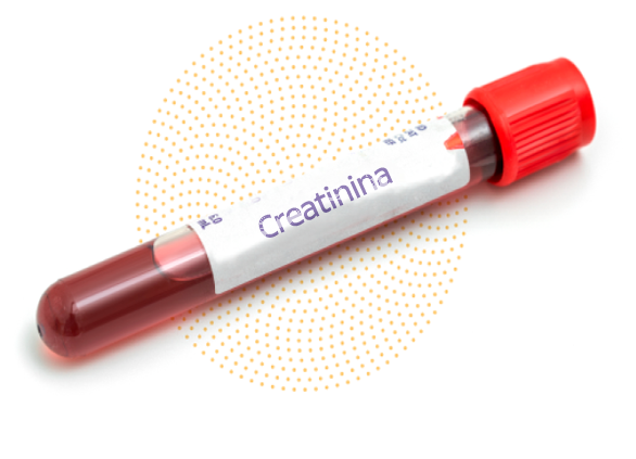 Creatinina.png
