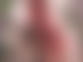 The Secret of Romance Fantasy Heroines – Flowing Hair Volume (Hair Transplant and Hairline Correction in Korea)