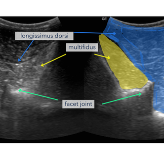 ultrasound image of anatomy of the horses vertebrae, related muscles and ligaments