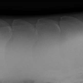 x-ray of moderate impinging of the horses spinous process commonly known as kissing spine