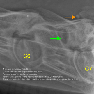 X-Ray of a horses cervical spine showing severe arthritis of C6-C7. a green arrow shows significant bone loss and an orange arrow shows a bone fragment 