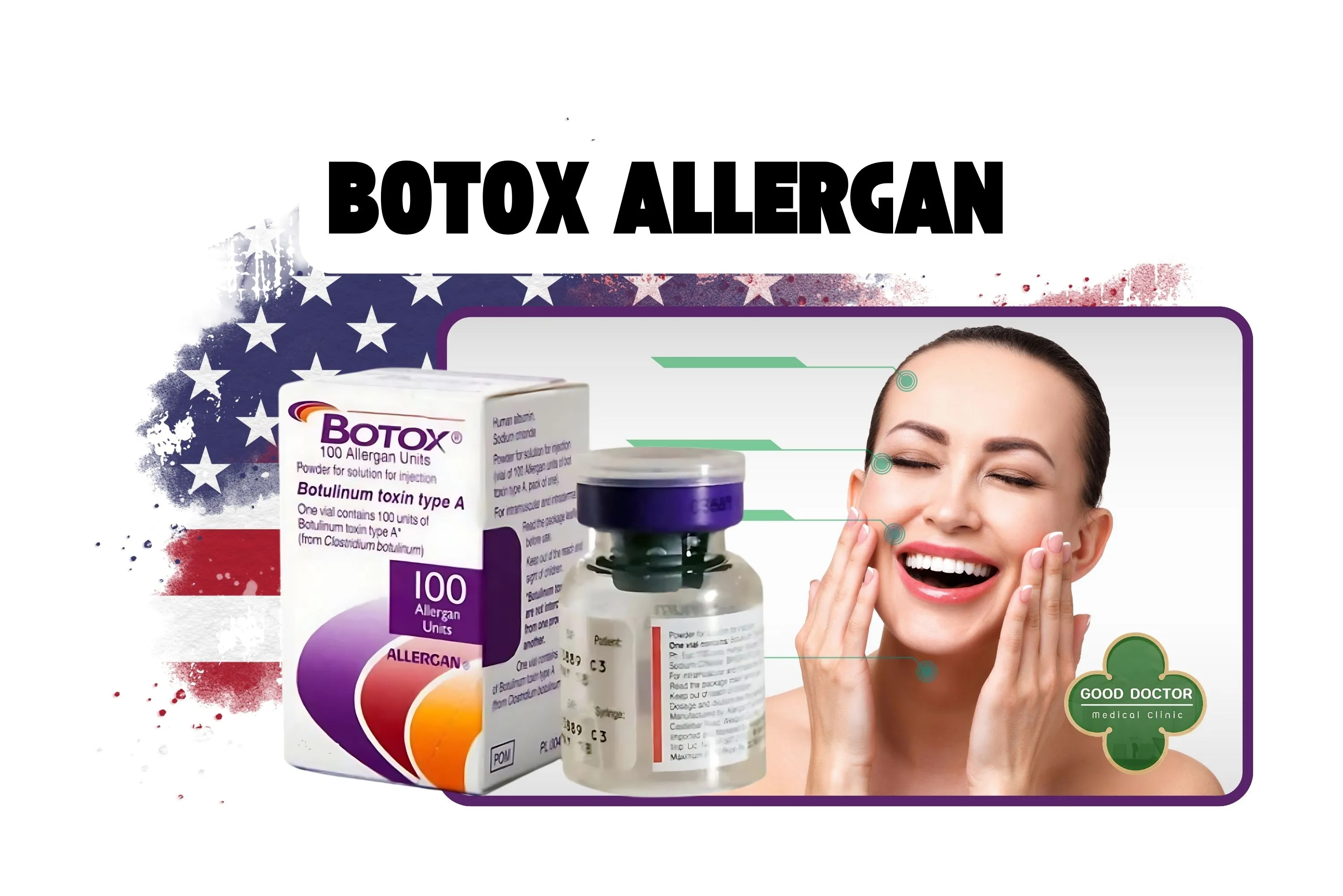 โบท็อกซ์ Allergan