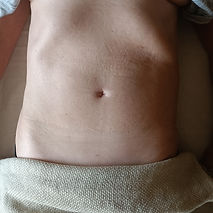 drainage lymphatique ventre