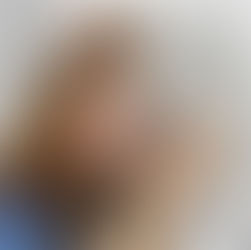 Calvície feminina: como tratar?