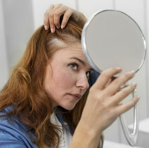 Calvície feminina: como tratar?