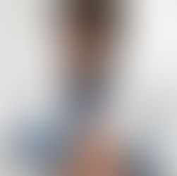 Cirurgião capilar: entenda a função do médico de transplante capilar