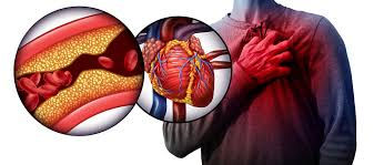 Medical illustration of a healthy human heart and clear blood vessels, representing heart health and cholesterol management.