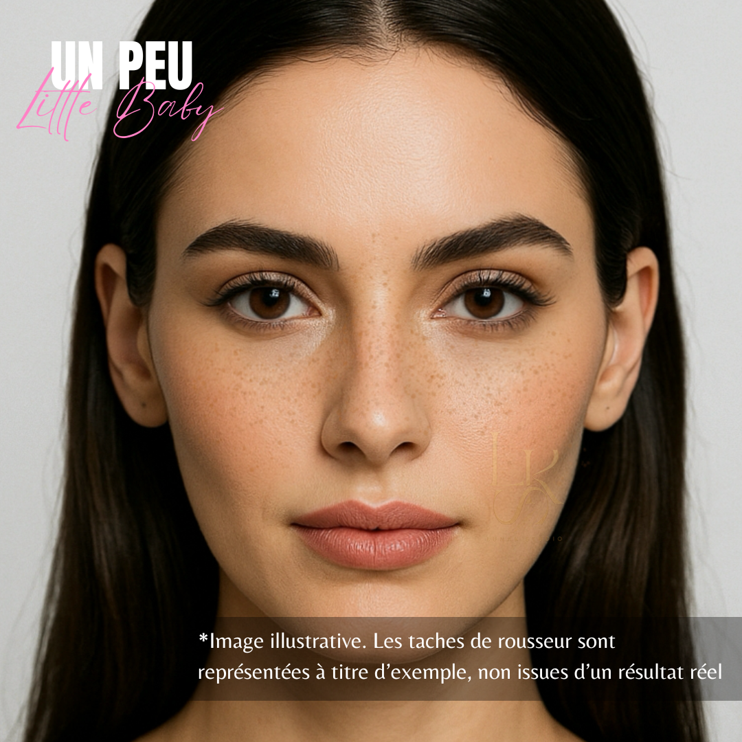 Taches de rousseur marseille
