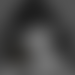 Les taches de rousseur : pourquoi l’automne est la saison idéale pour franchir le cap