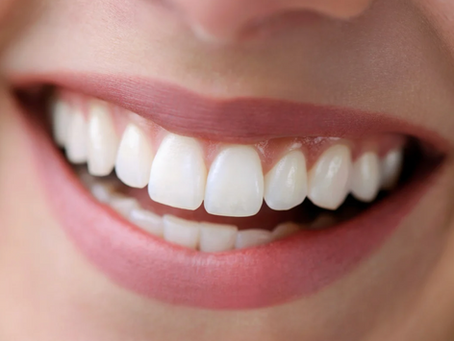 Woman smiling after orthodontic treatment