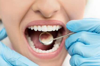 Smiling toddler at a check-up with a kids dentist in Sutton Coldfield, learning how to prevent tooth decay in children
