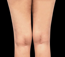 Rectangle 34624246.png