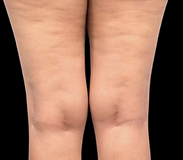 Rectangle 34624245 (1).png