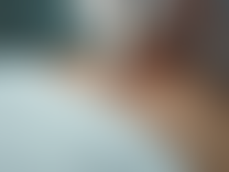 Unlock the Benefits of Microneedling for Your Skin: A Guide to Collagen-Boosting Treatments