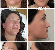 Kourtney Before and After.jpg
