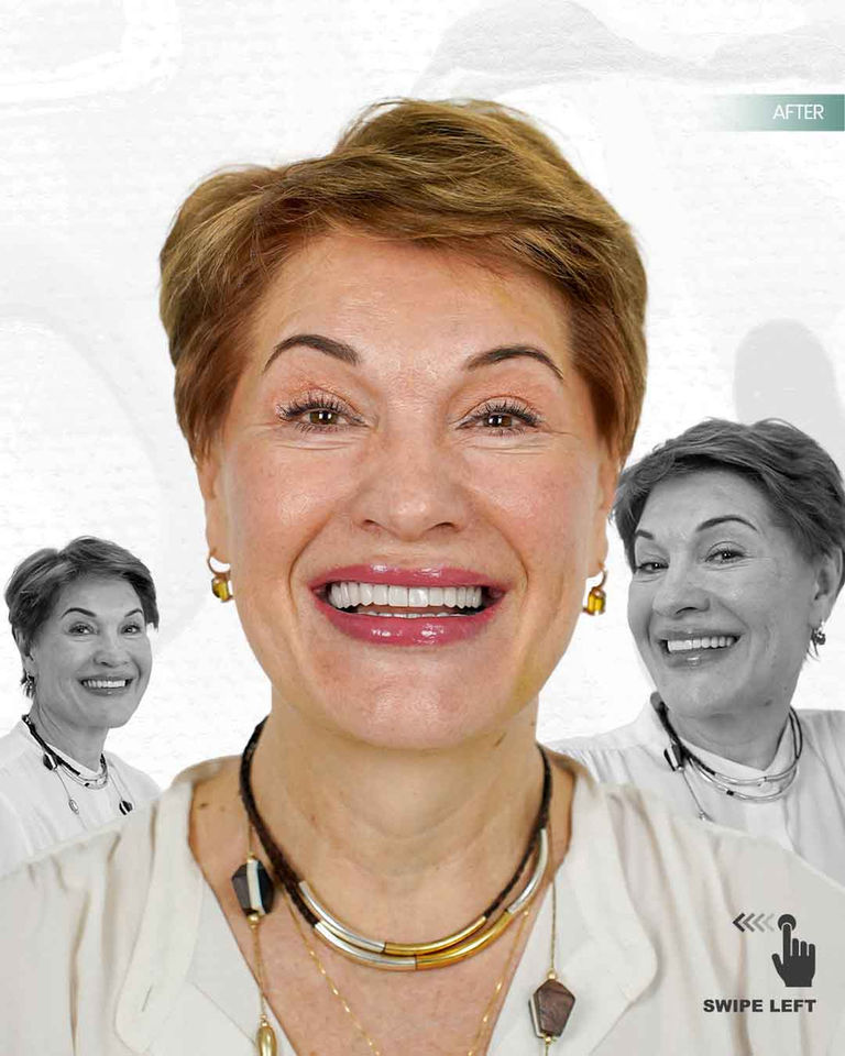 dentist turkey reviews izmir turkey