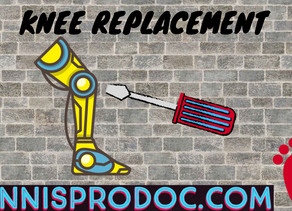 Knee Replacement