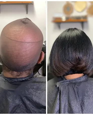 NonSurgical hair replacement, cranial prosthetic,wigs,mesh integration