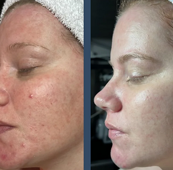 beforeaftercircadia