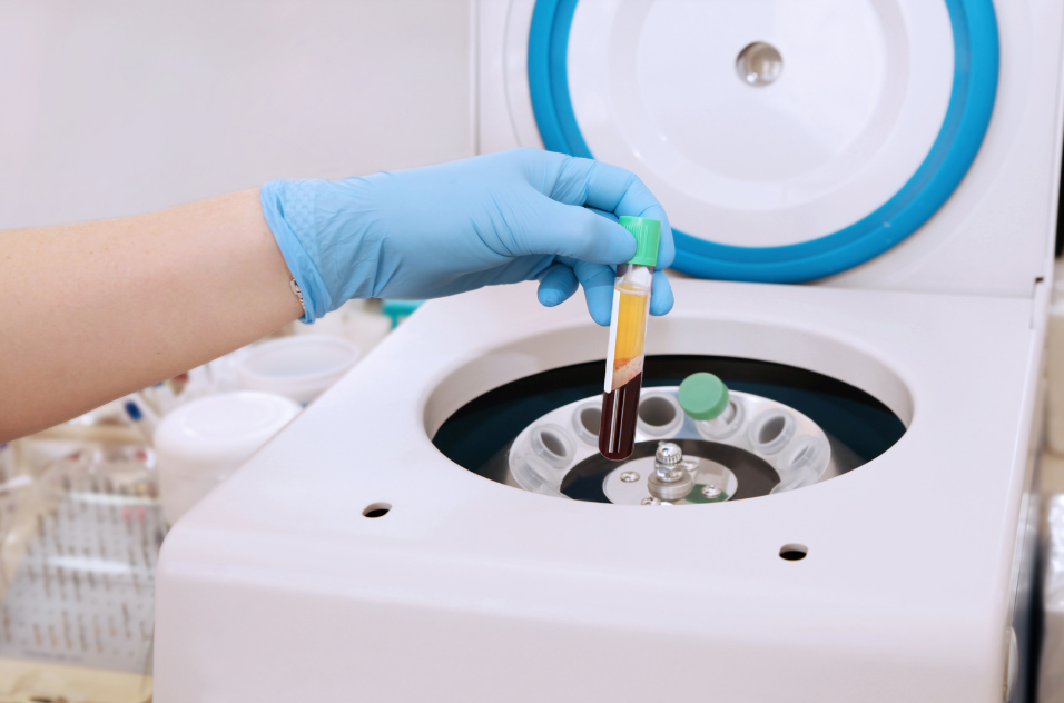PRP & PRF Treatment Preparation