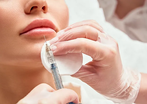 dermal fillers
