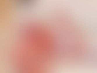 Treatment of OCD during a pandemic.