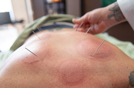 Cassie Trenhaile, Zensational in Faribault, MN Acupuncture