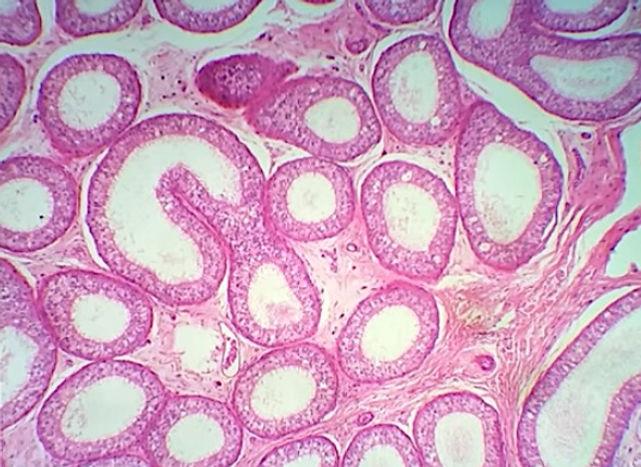 epididimo 40x.jpg