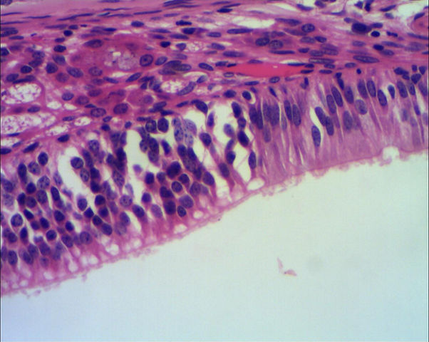 CAV NASAL 400x.jpg