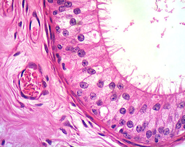 epididimo 400x.jpg