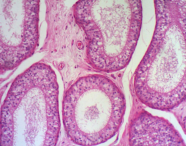 epididimo 100x.jpg