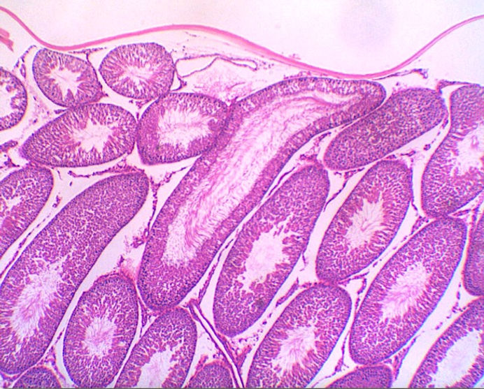 testiculo 40x.jpg