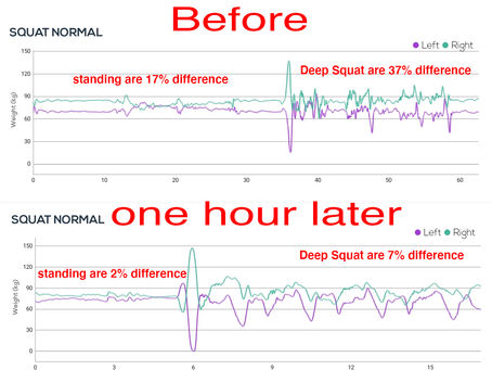 Balance Your leg strength and improve your sports performance