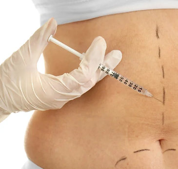 Mesoterapia corporal reductiva (3).webp