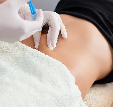 Mesoterapia corporal reductiva (2).webp