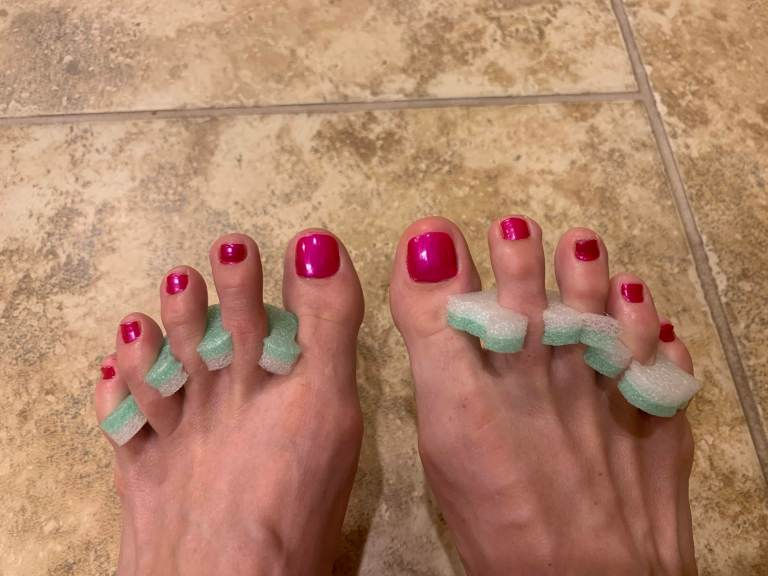 Chemo Toenails