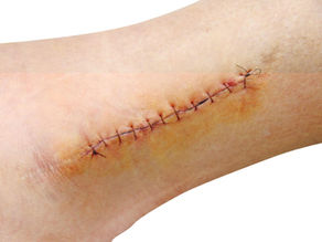 Tips for preparing your skin before surgery