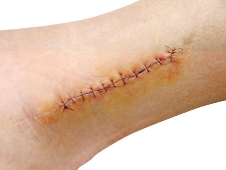 11 Essential Tips for Preparing Your Skin Before Surgery